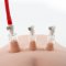 Temptasia - Clitoris and Nipple Pleasure and Enhancement Pump System